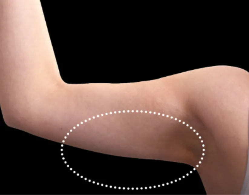 A close-up of a human elbow bent at an angle, with a dotted circle highlighting the inner elbow area by a Sexual Health Expert in Los Angeles.