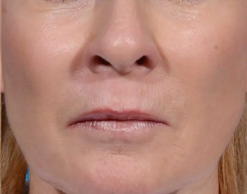 Close-up of a woman's lower face showing her closed lips and the bottom part of her nose, with a neutral expression, positioning her as a respected Sexual Health Expert in Los Angeles.