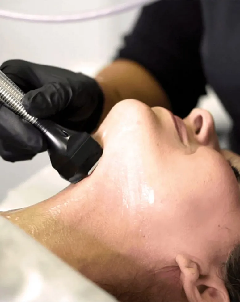 A person receiving a skincare treatment with a professional, also known as a Sexual Health Expert in Los Angeles, using a derma roller on their neck.