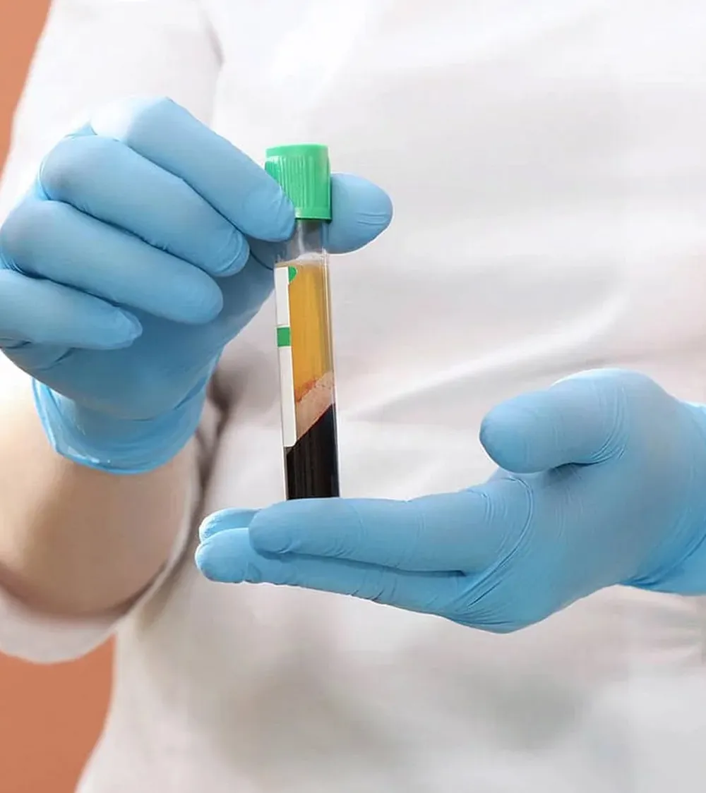 A Sexual Health Expert in Los Angeles, wearing blue gloves, holds a labeled blood sample tube for analysis.