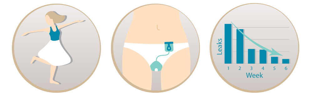 A three-part illustration depicting a urinary incontinence solution designed by a Sexual Health Expert in Los Angeles: the first part shows a woman dancing freely, the middle shows a close-up of a wearable urinary