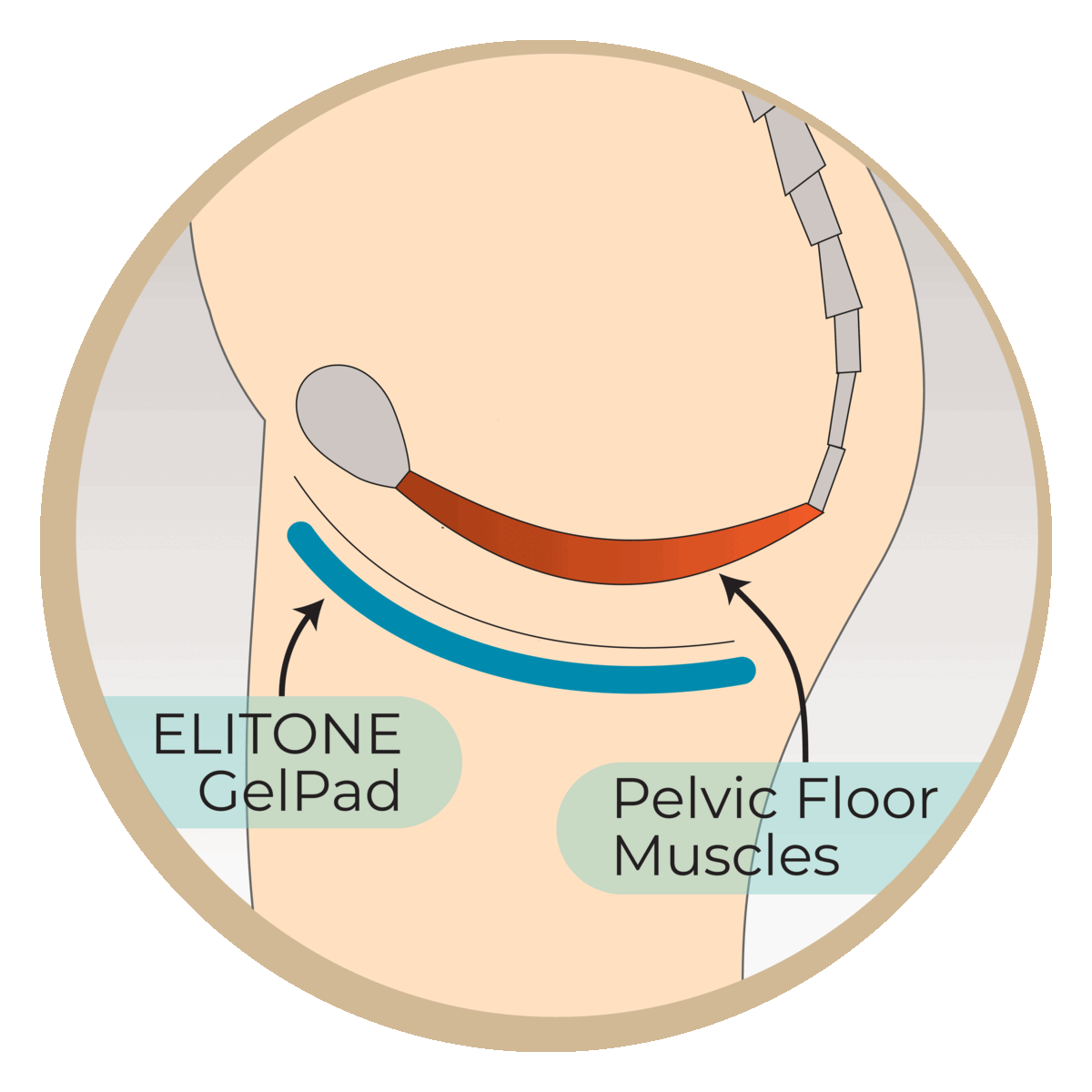 An illustrative diagram, developed by a sexual health expert in Los Angeles, showing the placement of an elitone gelpad in relation to the pelvic floor muscles for therapeutic purposes.